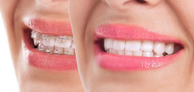 Advanced Dental Concepts | Sinus Lift, Emergency Treatment and Sedation Dentistry