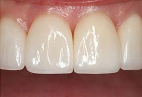 Advanced Dental Concepts | Extractions, Digital Radiography and Oral Cancer Screening