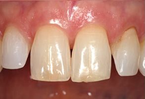 Advanced Dental Concepts | Dental Bridges, Digital Radiography and Oral Exams